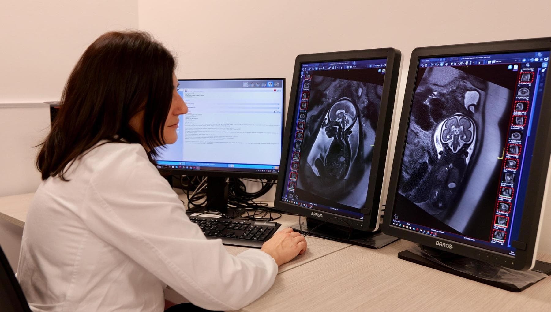 "Risonanza magnetica avanzata all'Ospedale Di Venere per diagnosi fetali e patologie complesse."